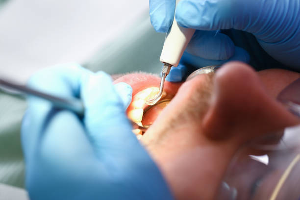 Best Weekend Emergency Dentist in Stone Ridge, VA