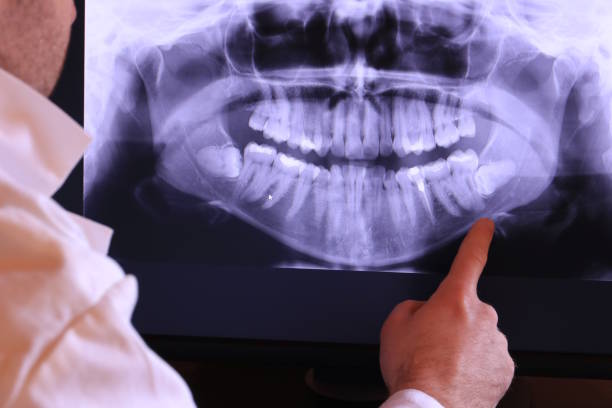 Best Emergency Treatment for Toothache in Stone Ridge, VA