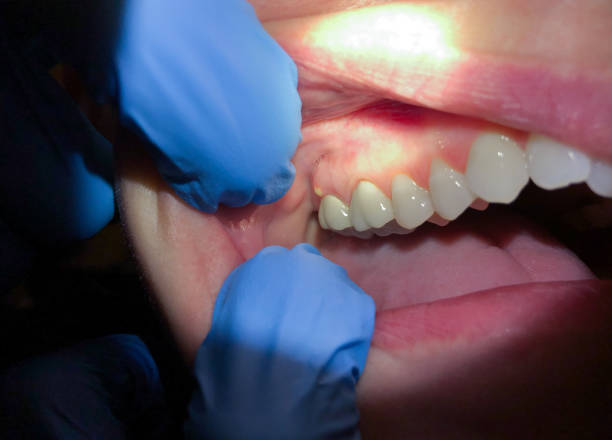 Best After-Hours Emergency Dentist in Stone Ridge, VA