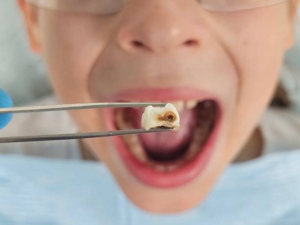 Best Emergency Dental Surgery in Stone Ridge, VA