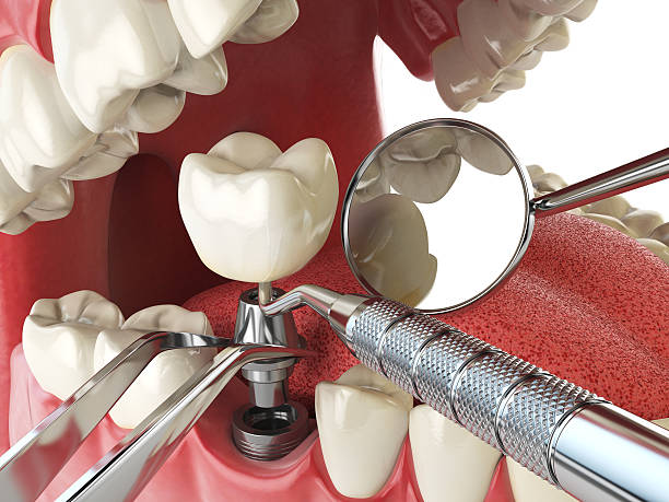  Stone Ridge, VA Emergency Dentist Pros